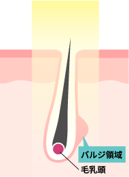 エステ脱帽のイメージ図