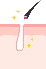 エステ脱帽のイメージ図